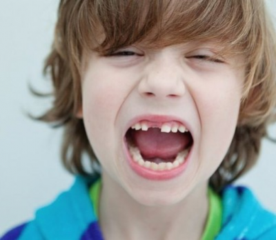 Tooth fairy pays most in the Maritimes, skips Quebec